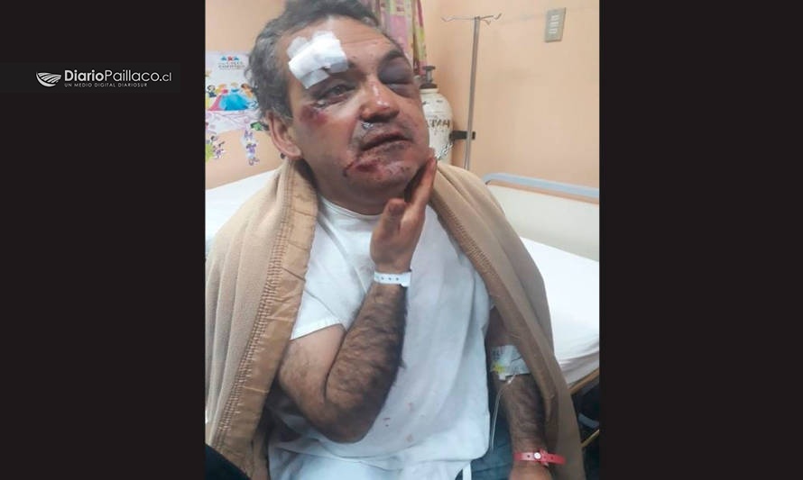 Padre recibió feroz golpiza en Paillaco: familia pide justicia
