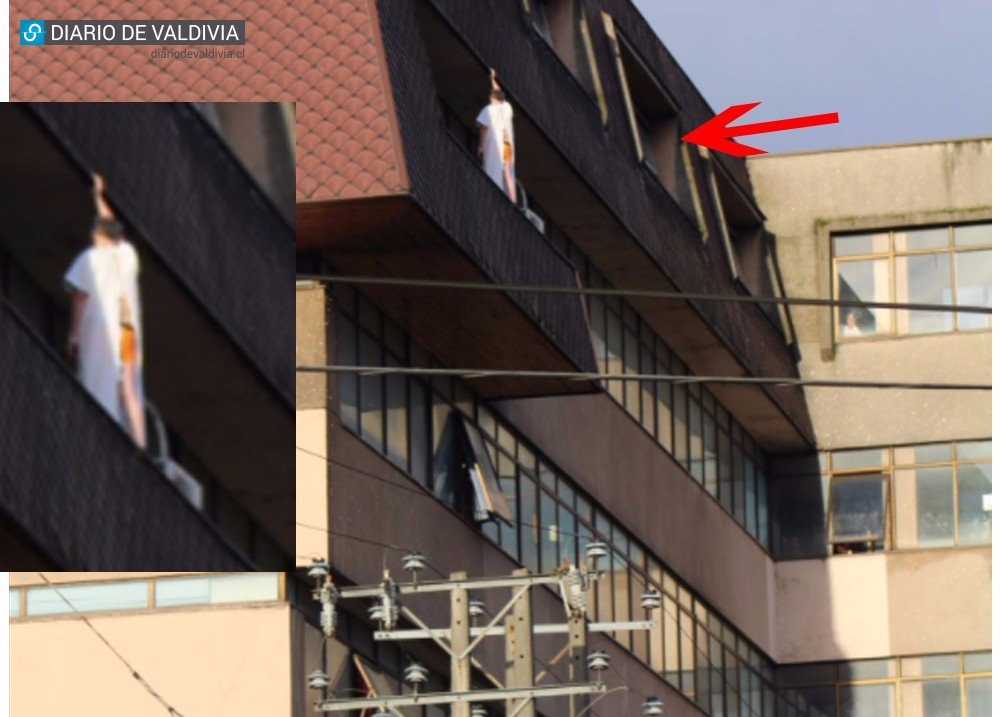 Hospital Base Valdivia se refirió al estado del paciente que intentó lanzarse desde el 4° piso